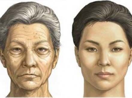 Типы старения лица фото деформирующий, морщинистый усталый.