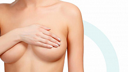 Реэндопротезирование груди