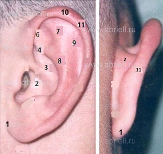 Операция на ушах