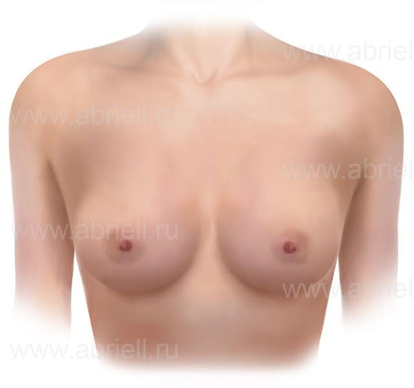 Виды женской груди