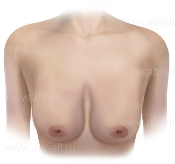 Виды женской груди
