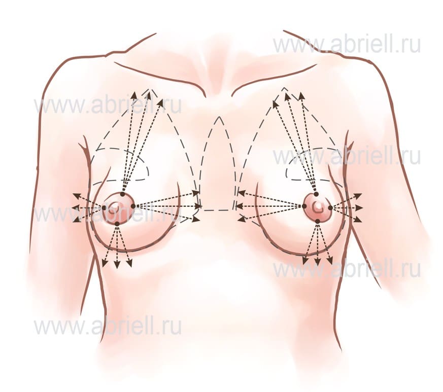 Как улучшить форму груди