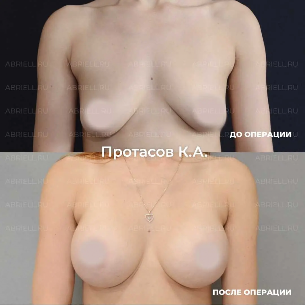 продукты увеличивающие грудь у женщин фото 62