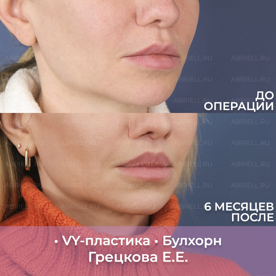 VY губ