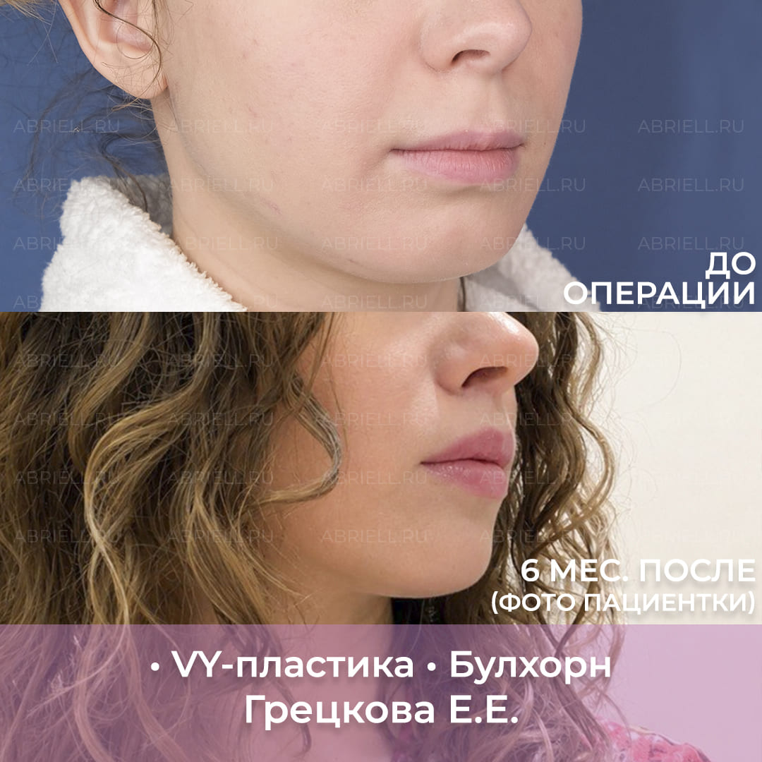 VY и Булхорн